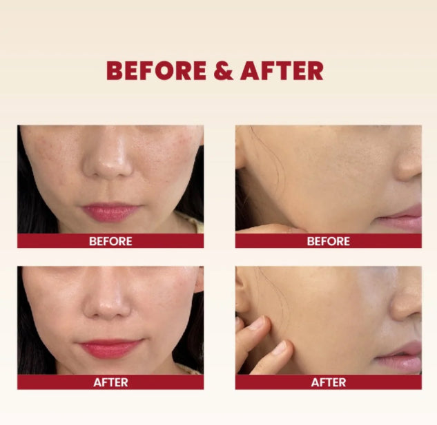 Seoul1988 Seoul 1988 cream: snail mucin 93% + rice