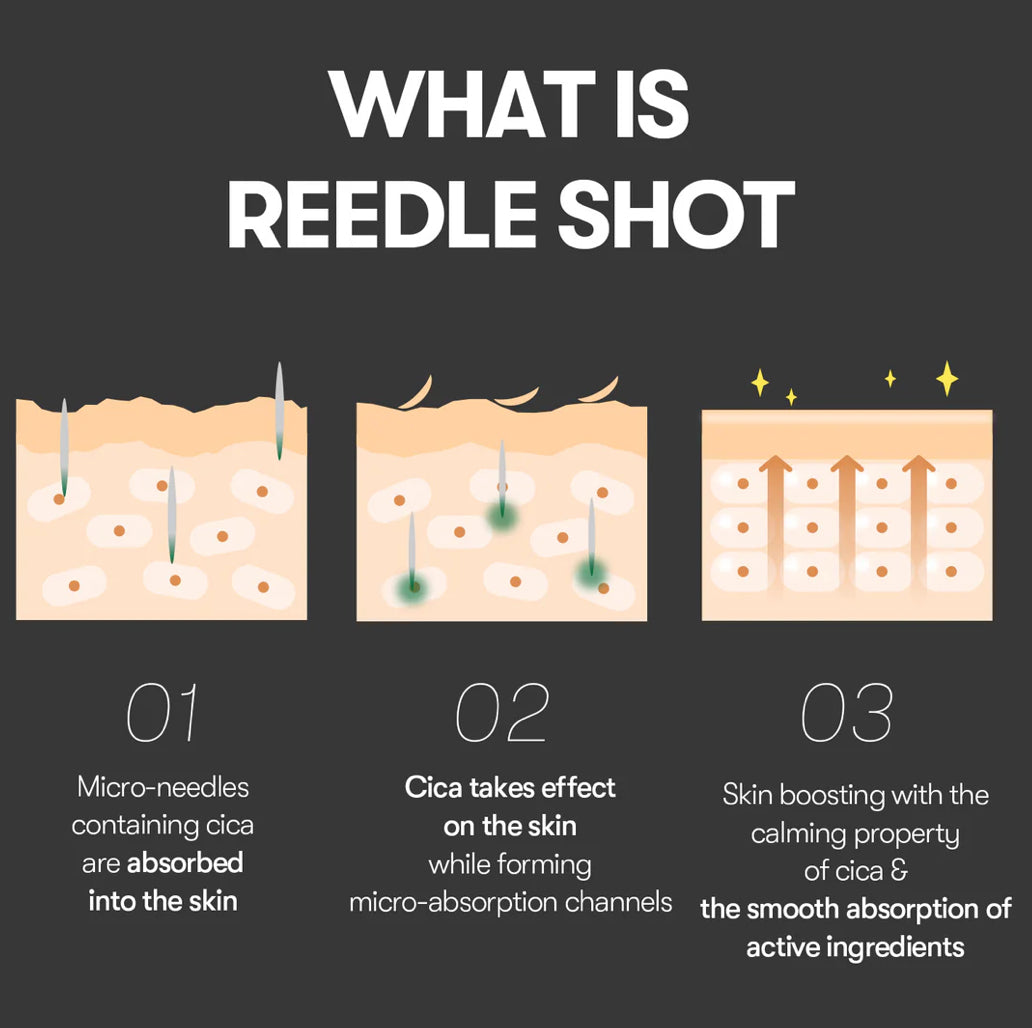 [CicaxHyalon] VT Reedle Shot 100